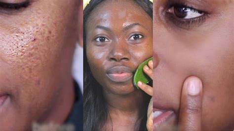 How To Get Rid Of Large Pores In Just 3 Days