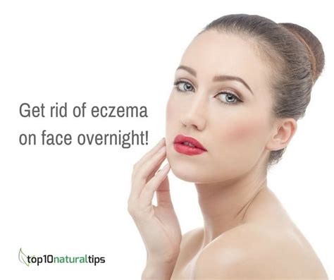 Get Rid Of Eczema On Face Overnight Naturally Face Eczema Get Rid Of