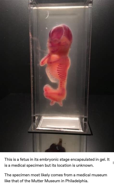 This Is A Fetus In Its Embryonic Stage Encapsulated In Gel It Is A