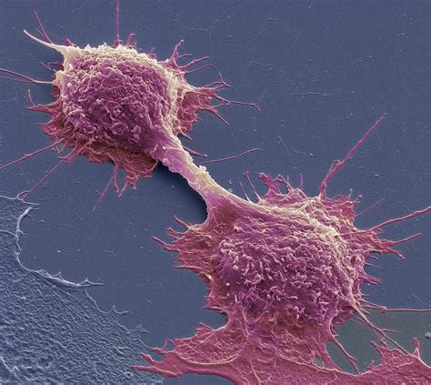 Dividing Cancer Cells Sem 1 Photograph By Steve Gschmeissner Fine