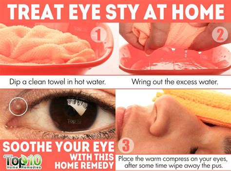 Home Remedies For Eye Sty Stye Top 10 Home Remedies