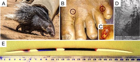 A Indian Crested Porcupine Hystrix Indica B Injured Left Foot Of The