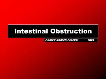 Ppt Intestinal Obstruction Powerpoint Presentation Free To View