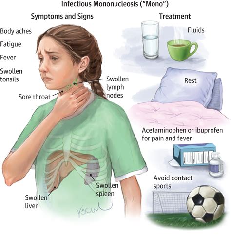 The infection classically occurs in teenagers and young adults, hence its other name. Infectious Mononucleosis | Allergy and Clinical Immunology ...