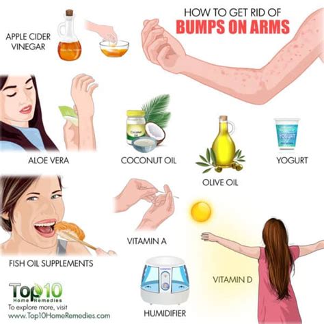 How To Get Rid Of Bumps On Arms Top 10 Home Remedies