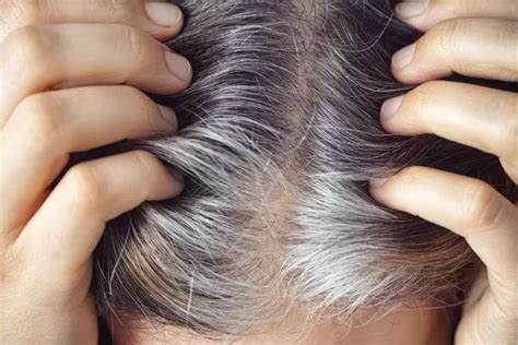 Can Stress Cause Premature Gray Hair Atonibai