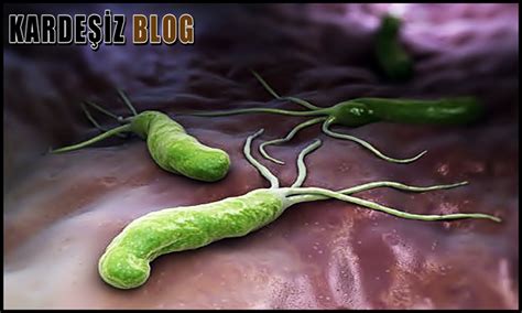 Helicobacter Pylori Mide Mikrobu Nedir Mide Mikrobu Belirtileri