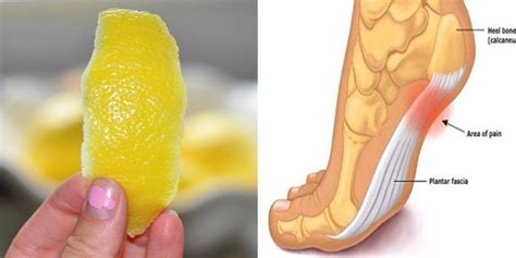 Citronová kůra vám může pomoci se zbavit bolesti kloubů iRecept