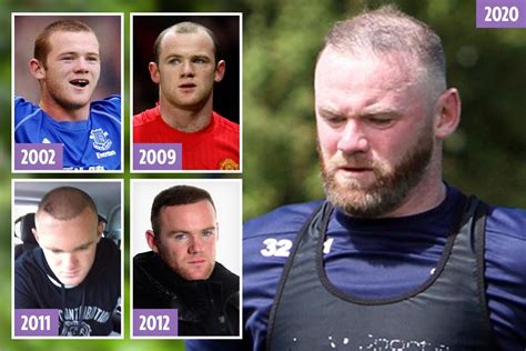 Wayne Rooney’s Hair Is Thinning Again — Despite Spending ‘£30k’ On Hair Transplants The Irish