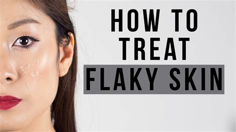 How To Treat Flaky Skin Tips Products Viestelook Youtube