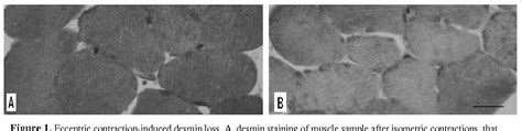 Figure 1 From Temperature Changes During And After Eccentric