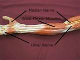 The arm muscles comprise five muscles, which mainly act to flex and extend the forearm. Elbow & Lower Arm | Chandler Physical Therapy