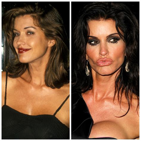 Plastic Surgery Gone Wrong — Celebs Who Regret Going Under The Knife