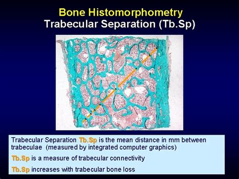 Bone Histology And Histopathology For Clinicians A Primer