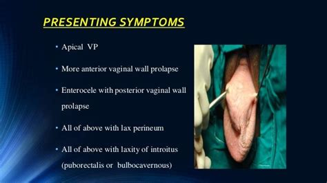 Vault Prolapse Pelvic Organ Prolapse Supports Of Uterus