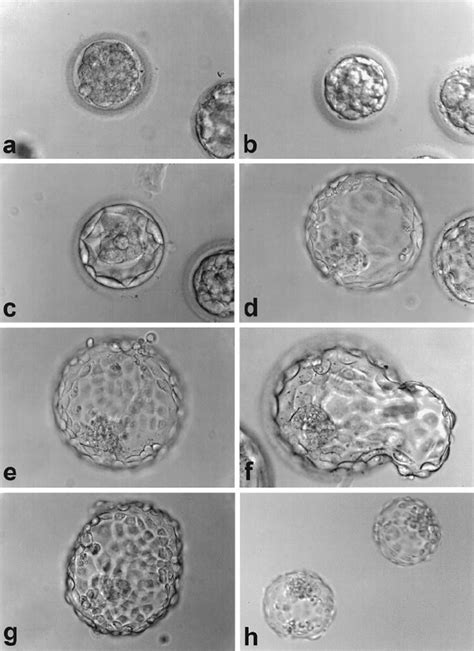 Examples Of The Embryo Developmental Stages Selected For Transfer On