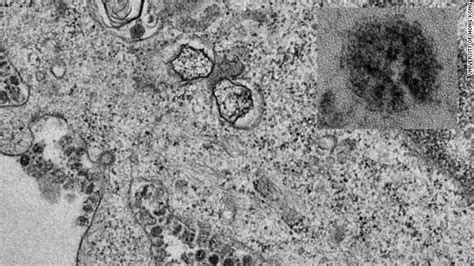 Magnified Images Show Coronavirus Replicating