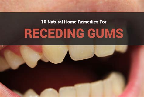What Causes Receding Gums 10 Home Remedies 99easyrecipes