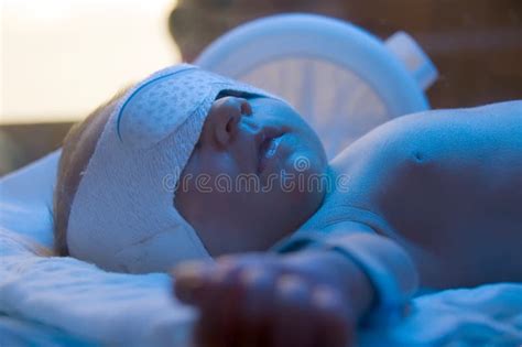 Newborn Jaundice Treatment Stock Photo Image Of Infants 5220018