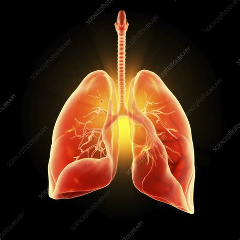Human Lungs Pneumonia Illustration Stock Image C0587185