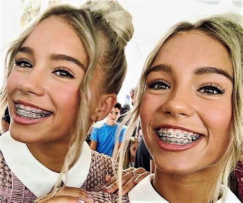 braces girls cute braces celebrities with braces woman face lisa teen female faces