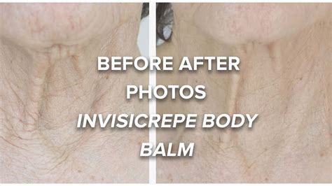 Invisicrepe Body Balm Reviews What Do Experts Say Cheaperks