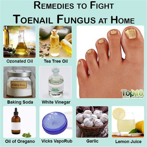 10 Remedies To Fight Toenail Fungus At Home Top 10 Home Remedies