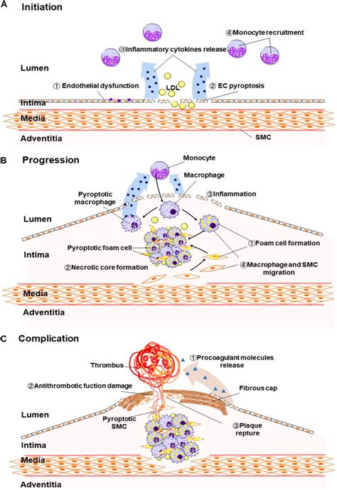 Frontiers Pyroptosis In The Initiation And Progression Of Atherosclerosis