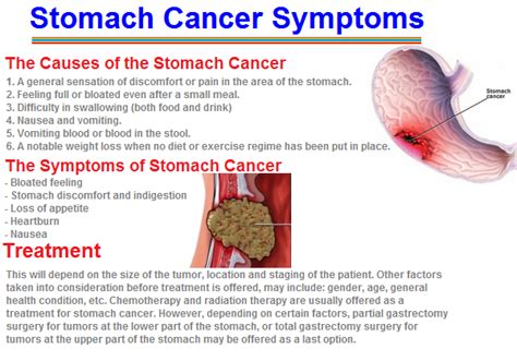 Stomach Cancer Symptoms Causes Diagnosis And Treatment