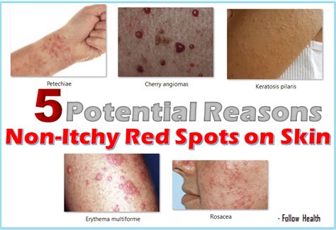 5 Potential Reasons For Non Itchy Red Spots On Skin Exploring Possible