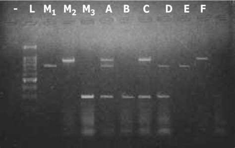 Mrt Pcr For Bcov D E Bovine Rotavirus C F Bvdv B C D