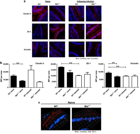 Altered Epithelial Tight Junction TJ Due To Downregulation And