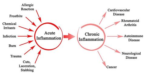 Chronic Vs Acute Inflammation Know The Difference Nmami Life