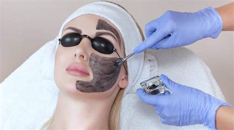 Carbon Laser Peel Facial All You Need To Know