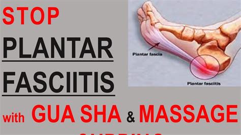 🦶 Stop Plantar Fasciitis Try Massage Cupping Organic Sha 2020 Youtube