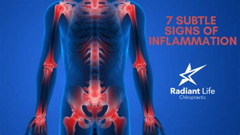 7 Subtle Signs Of Inflammation Radiant Life Chiropractic