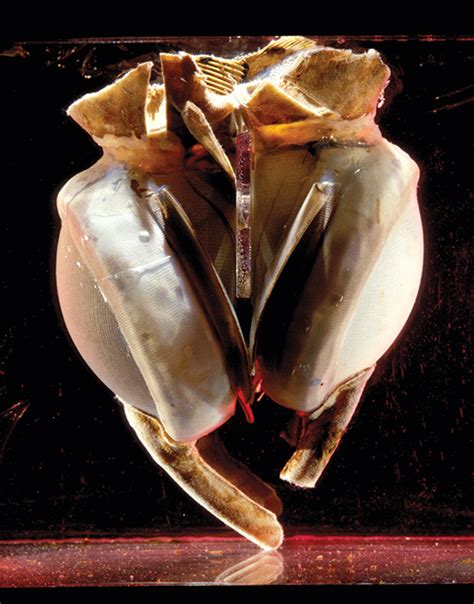 An Imperfect Heartbeat Has The Artificial Heart Fulfilled Its Promise