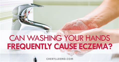 Can Washing Your Hands Too Frequently Cause Eczema