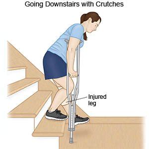 Is there a difference between go upstairs and go up the stairs? Crutch Instructions - What You Need to Know