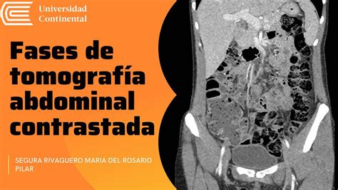 Tomografia Abdominal Com Contraste