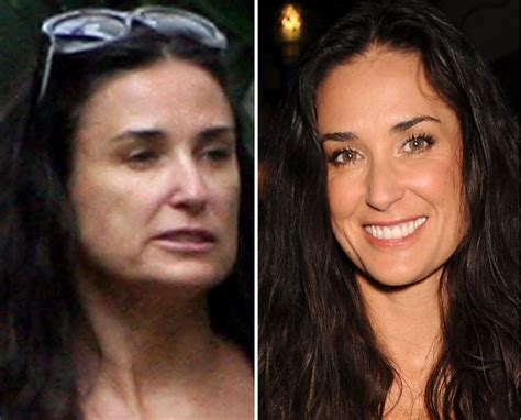 Pin on Plastic Surgery Nightmares