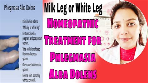 What Is Phlegmasia Alba Dolens And Homeopathic Treatment Of