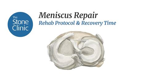 Meniscus Repair Surgery Rehab Protocol And Recovery Time Post Op Rehab