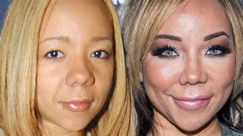 The Truth About Tiny Harris Plastic Surgery Procedures Youtube