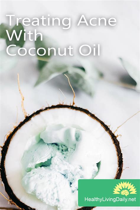 4 Tips On Treating Acne With Coconut Oil 🤔😮👍🥥 Ampgsk4on