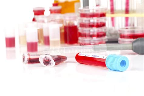 Blood Sample In A Test Tube Stock Photo Image Of Glassware