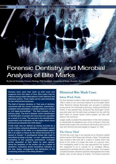 Forensic Dentistry And Microbial Analysis Of Bite Marks Pdf 398kb