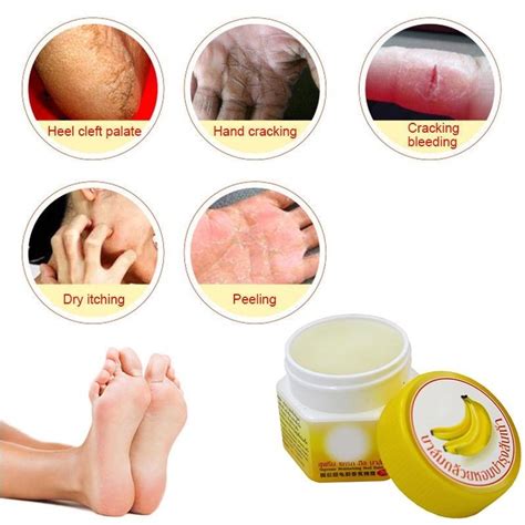 Buy Cracked Heel Cream For Rough Dry Cracked Chapped Feet Remove Dead Skin Foot Care At