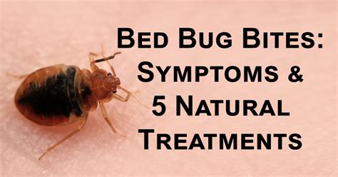 What Do Bed Bug Bites Look Like Pictured Public Healt Vrogue Co
