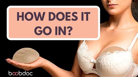 How Do You Insert A Breast Implant Find Out How It Goes In YouTube